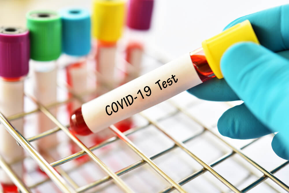 COVID-19/Influenza/RSV Testing