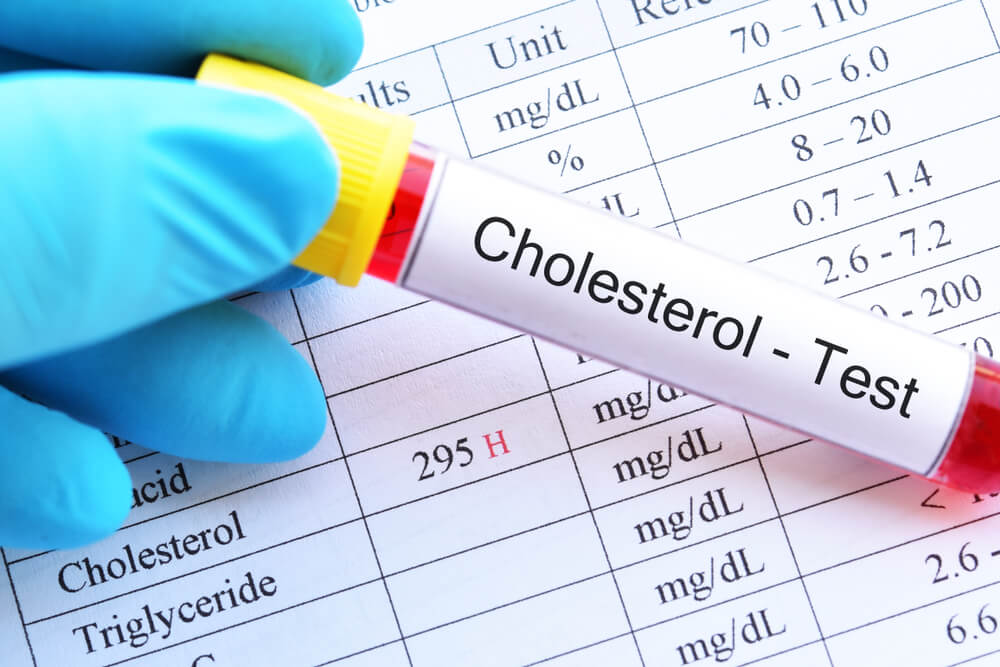 High Cholesterol Screening & Monitoring