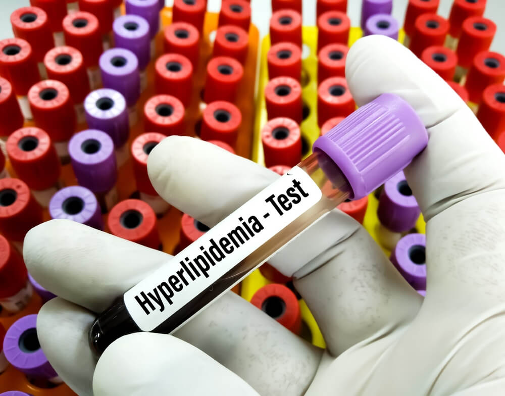 Hyperlipidemia