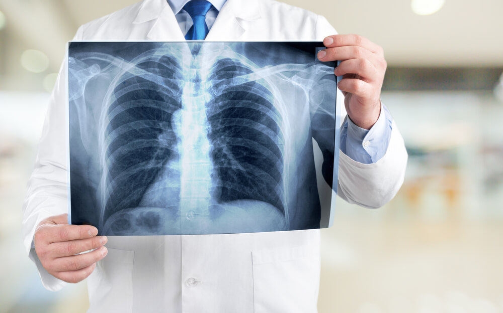Unveiling the Secrets of Pulmonary Health