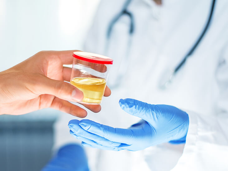 Urine Testing - Urinary Tract Infections (UTIs)