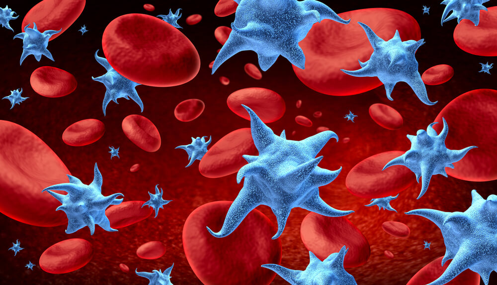 Thrombocytopenia Care and Platelet Disorder Treatment